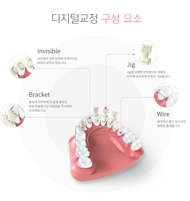 강서 라이프치과