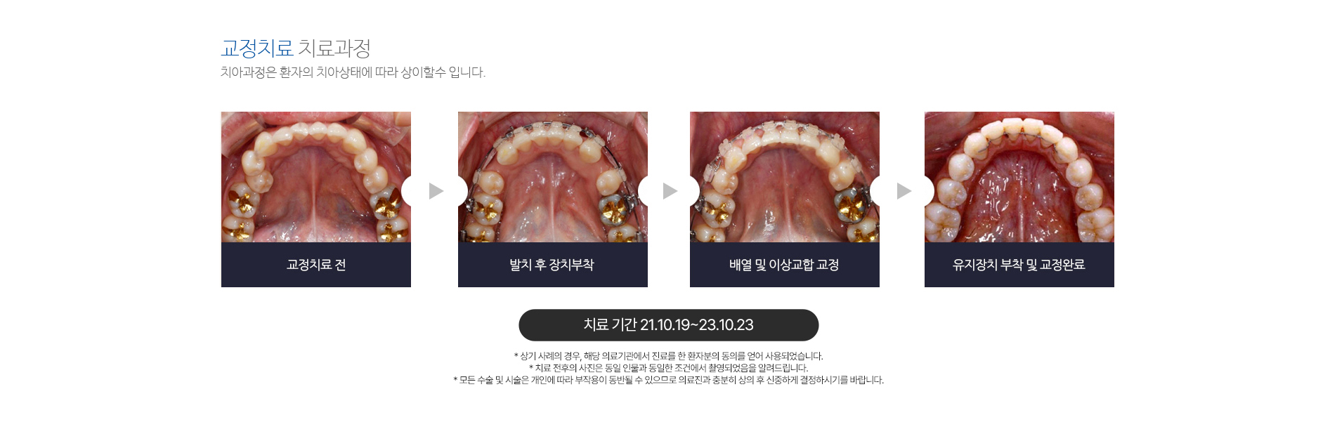 라이프치과 치아교정