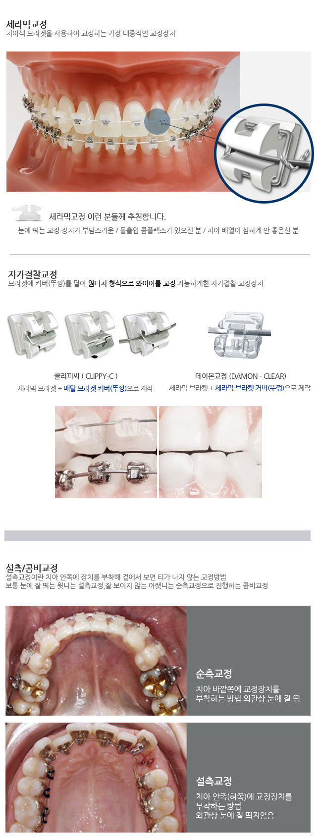장치별 교정종류