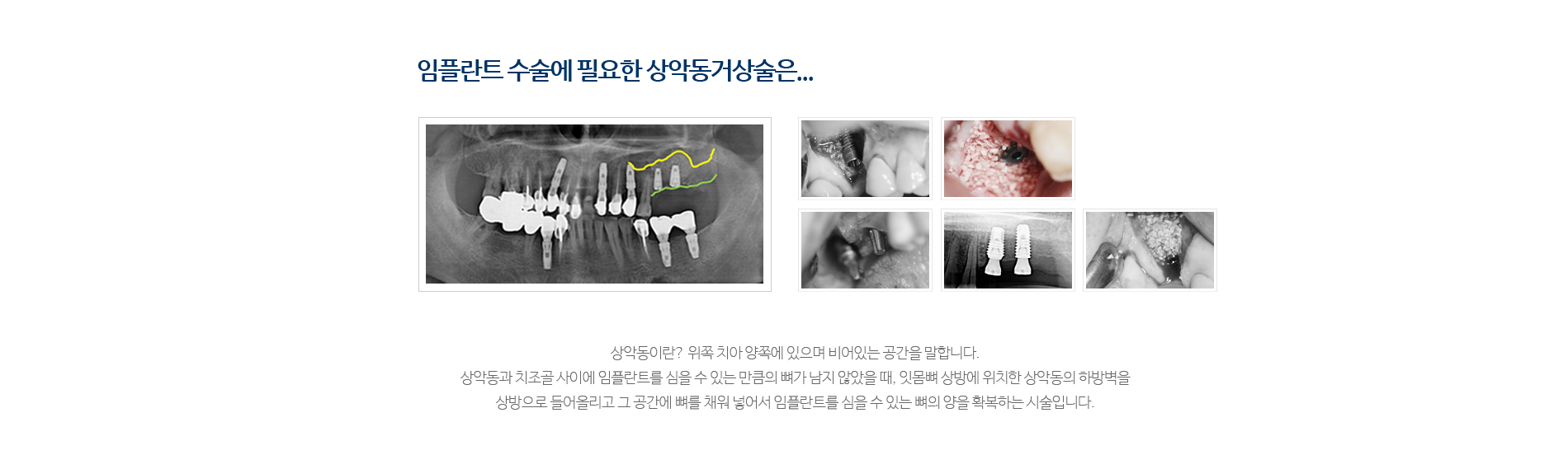 서울라이프치과